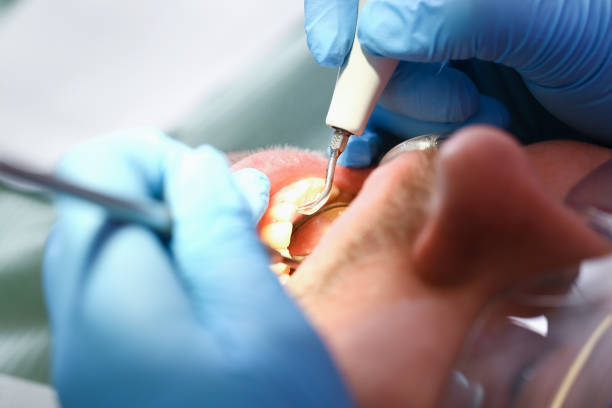 Best Mobile Emergency Dentist in Capitol Heights, MD