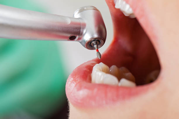 Best Urgent Dental Care for Toothache in Capitol Heights, MD